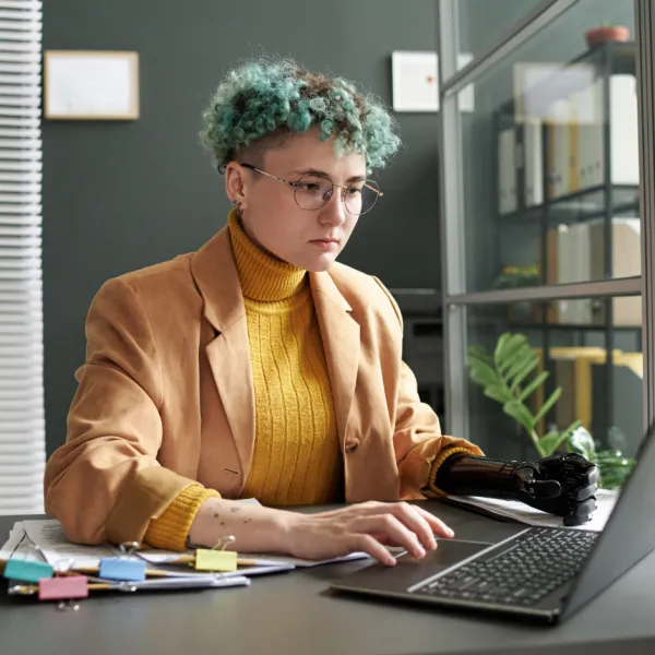 worker with prosthetic arm working in office with documents